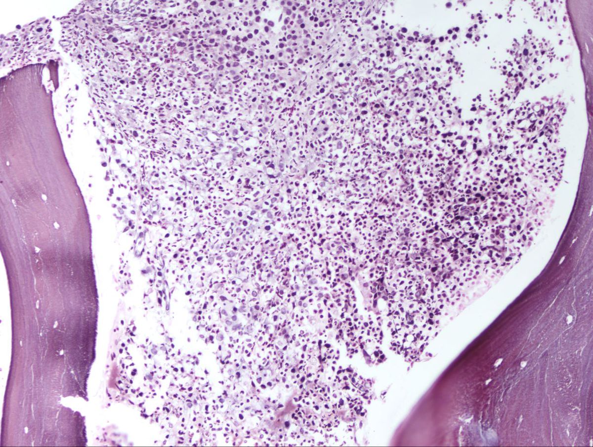 Reticulin Stain