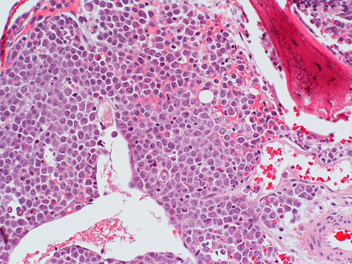 H&E section of L3 mass