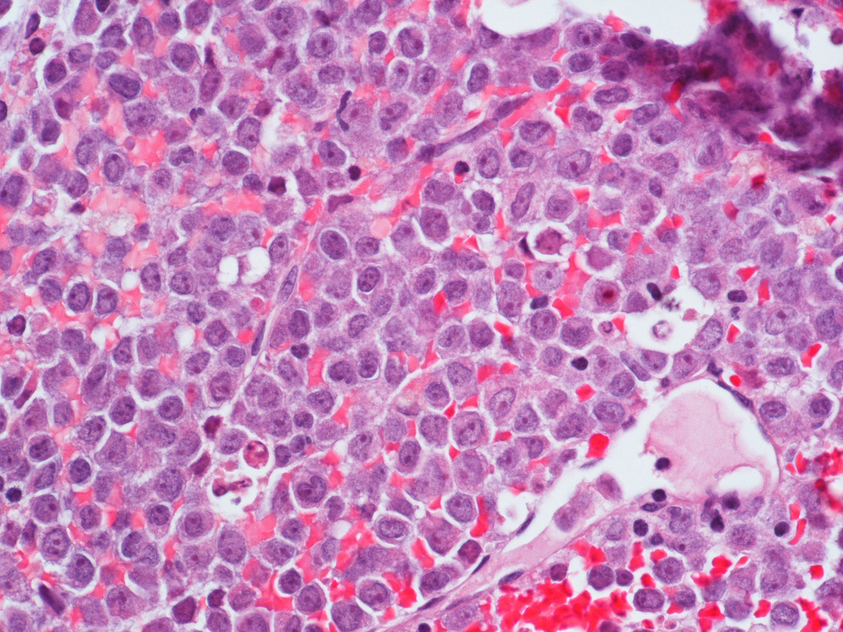 H&E section of L3 mass