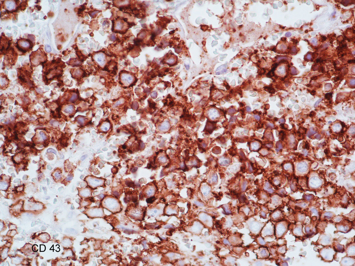 CD43