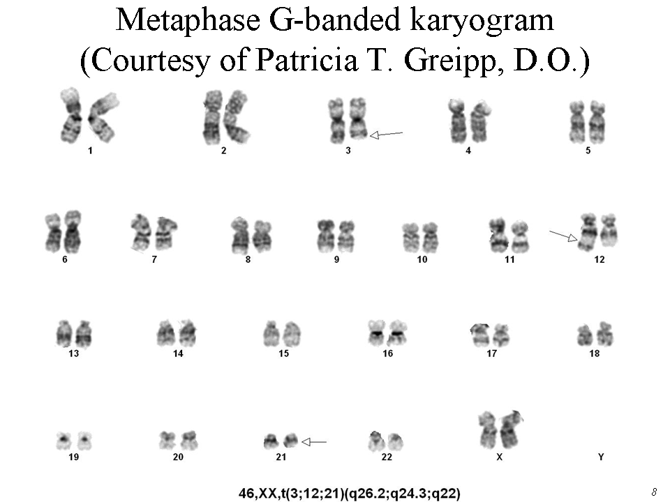 Metaphase G-banded karyogram (Courtesy of Patricia T. Greipp, D.O.)
