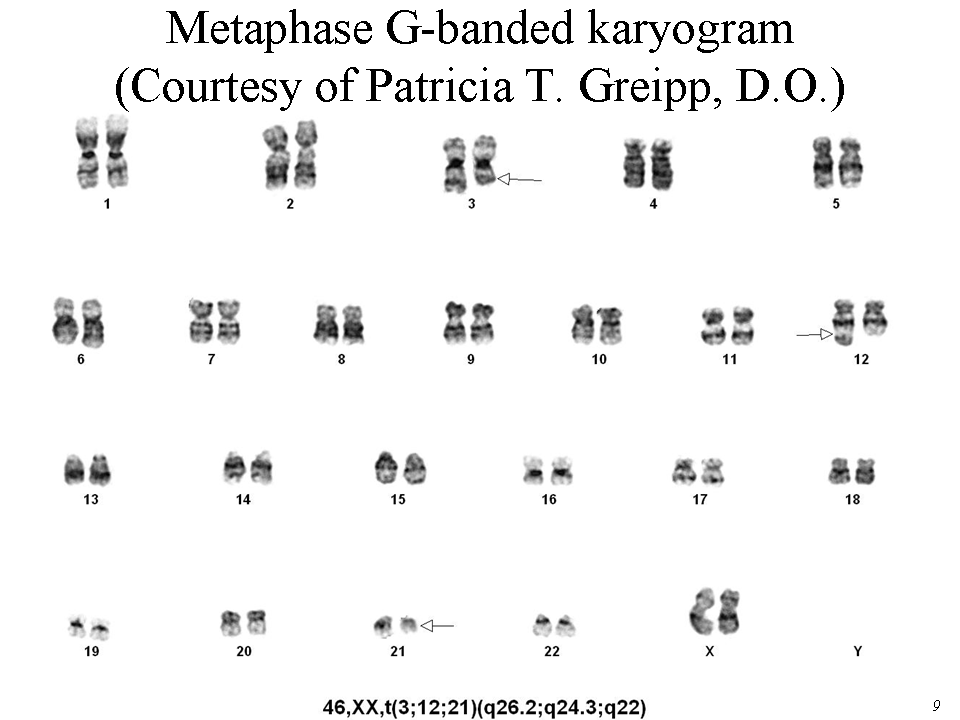 Metaphase G-banded karyogram (Courtesy of Patricia T. Greipp, D.O.)