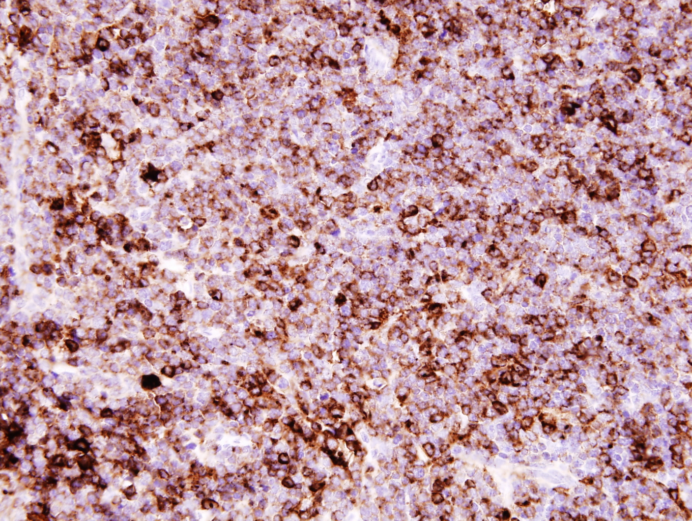 Additional figure 1: CD11c IHC, 400x