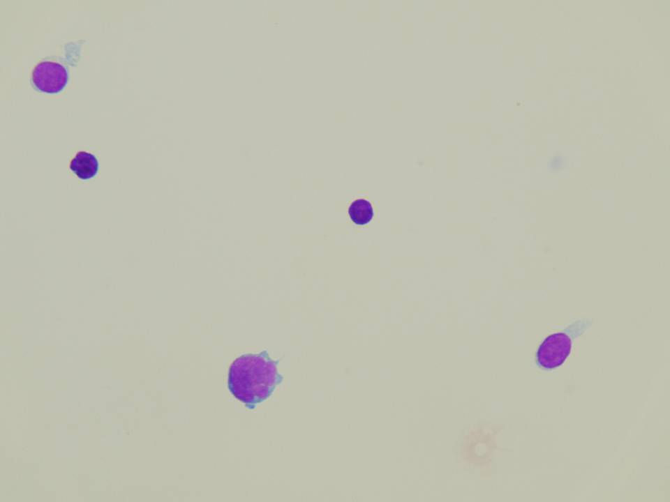 Cerebrospinal fluid