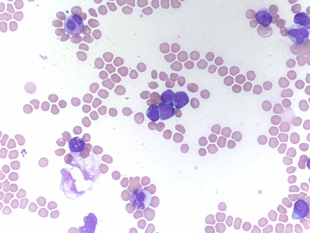 Peripheral blood