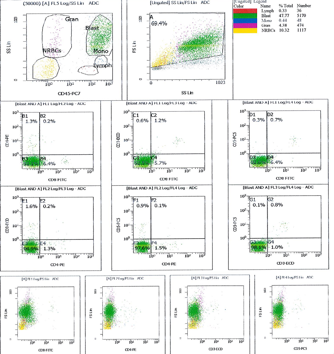 Flow cytometry histograms showing that immature cell population is negative for lymphoid markers