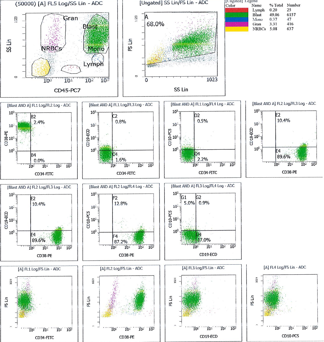 Flow cytometry histograms showing that immature cell population is positive for CD38 and negative for CD19 and CD10