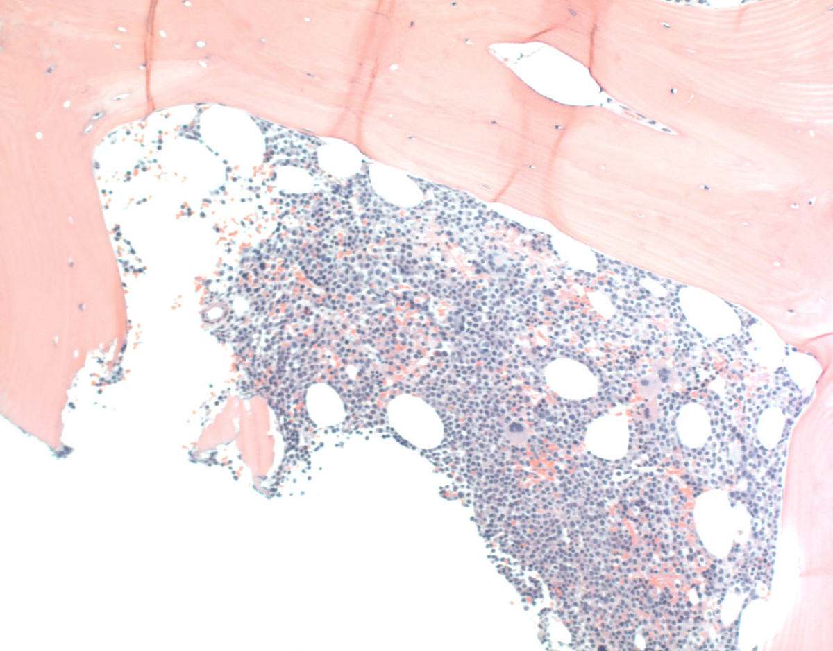 Core biopsy
