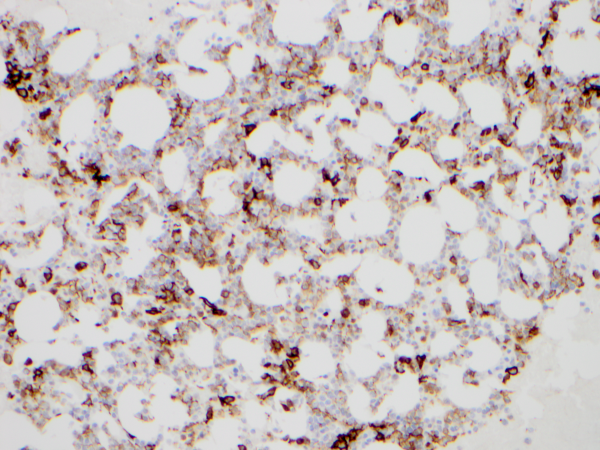 Additional figure 2: CD11c IHC