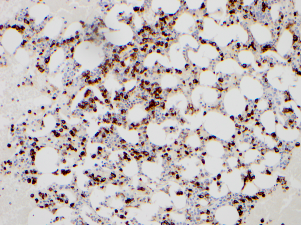 Additional figure 3: Lysozyme IHC