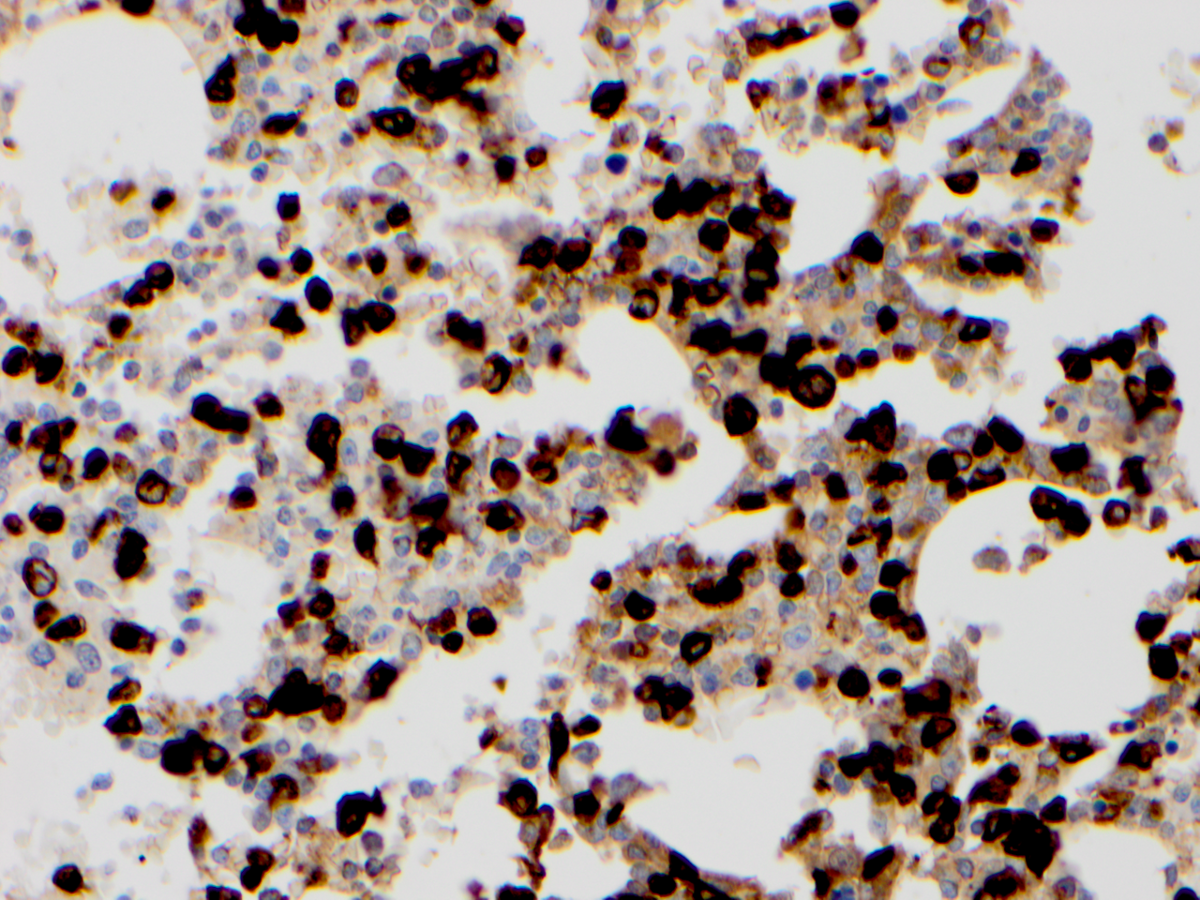 Additional figure 4: MPO IHC